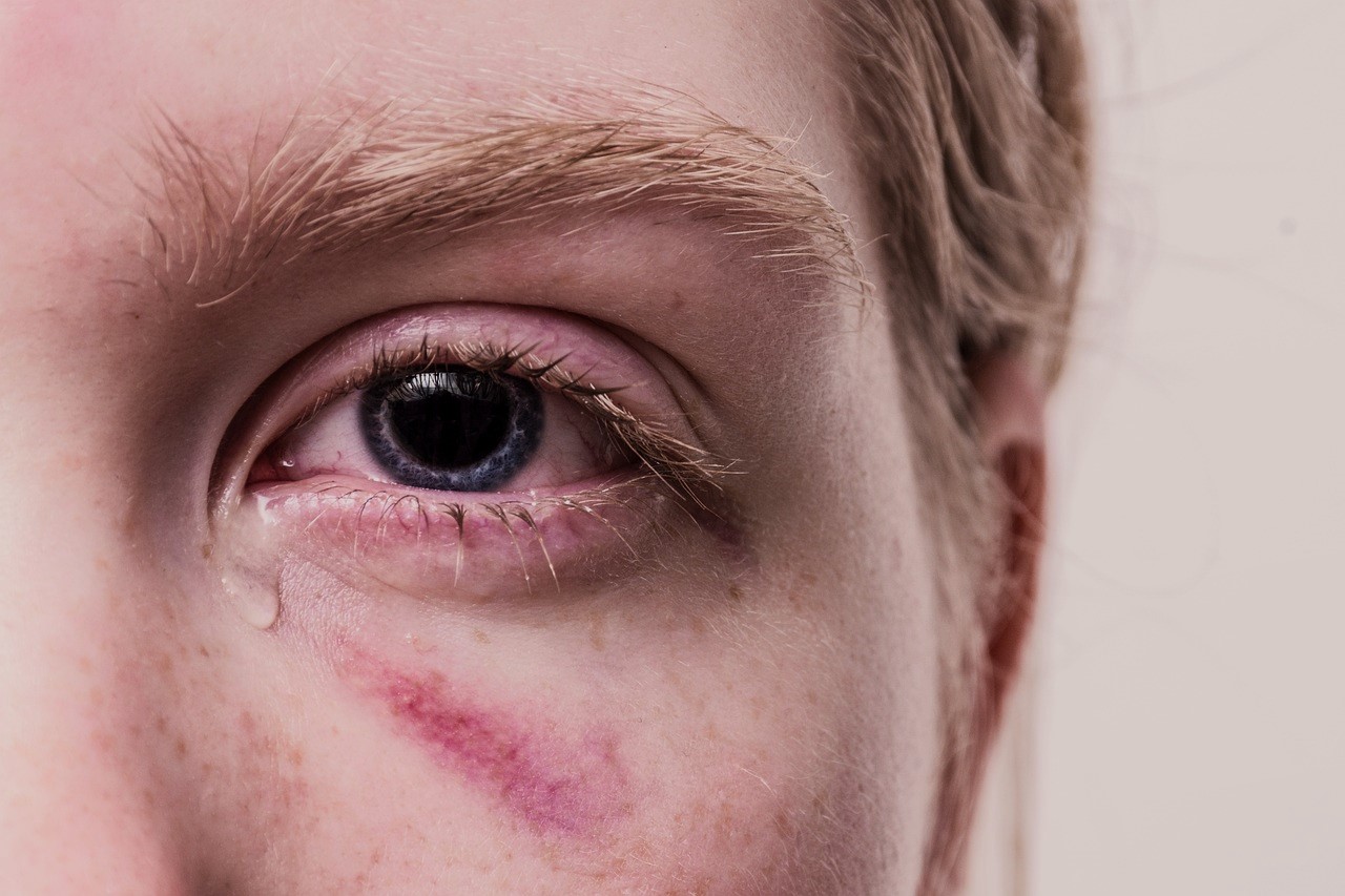 EMDR psicoterapia Gestalt